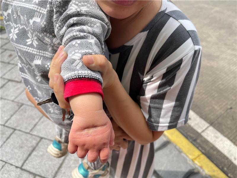 危险!幼儿手被卡门缝,情况如何?